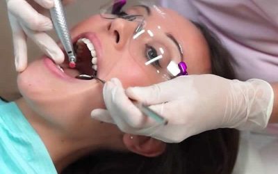 Limpeza dental e remoção de tártaro