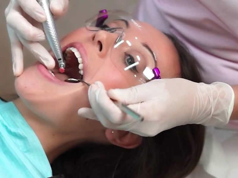 Limpeza dental e remoção de tártaro